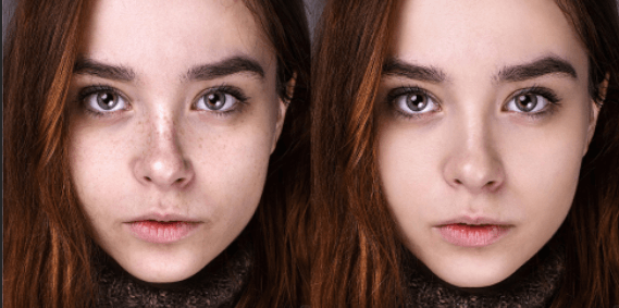 其实去斑不用死磕磨皮,选对工具分分钟搞定。今天把我帮家人朋友修图的实战技巧分享给你,再附上StartAI banana的“懒人捷径”