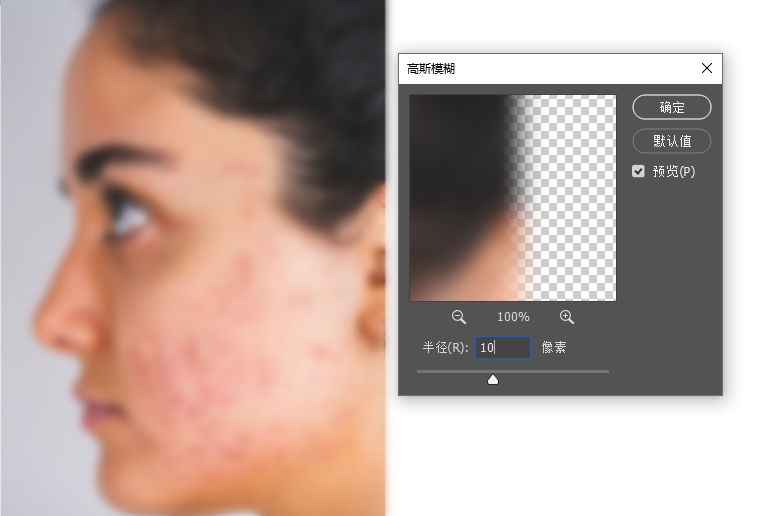 利用PS高斯模糊 + 黑色蒙版进行磨皮