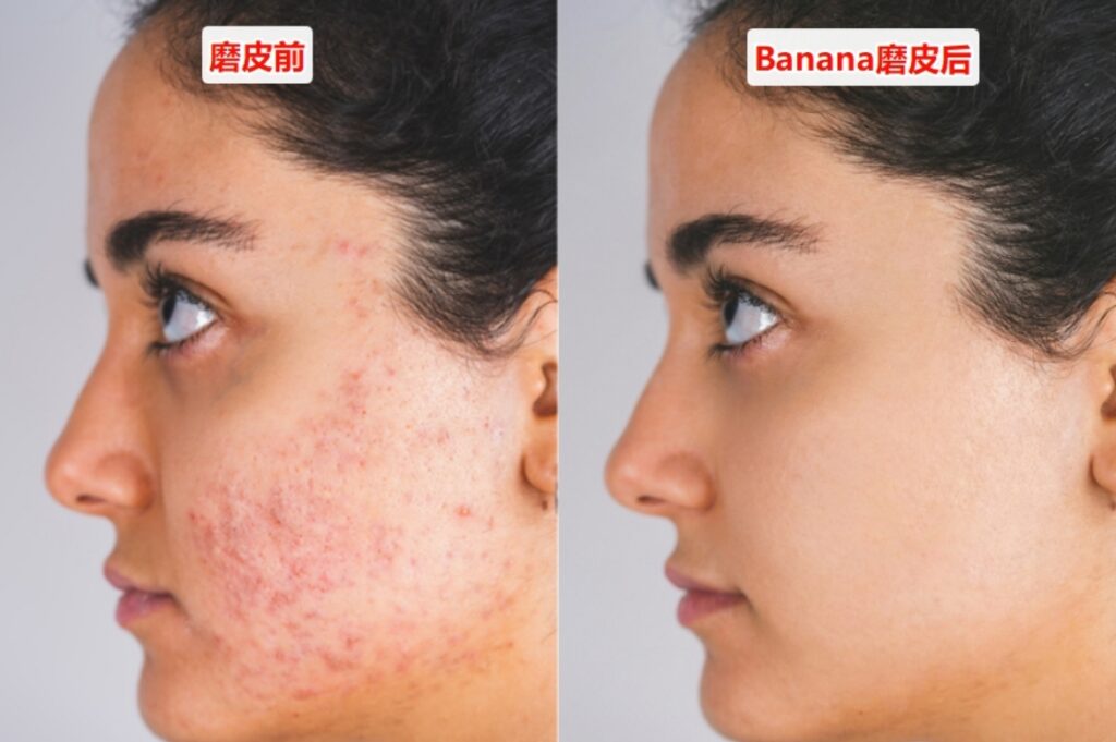 Banana修图去除痘痘斑点效果
