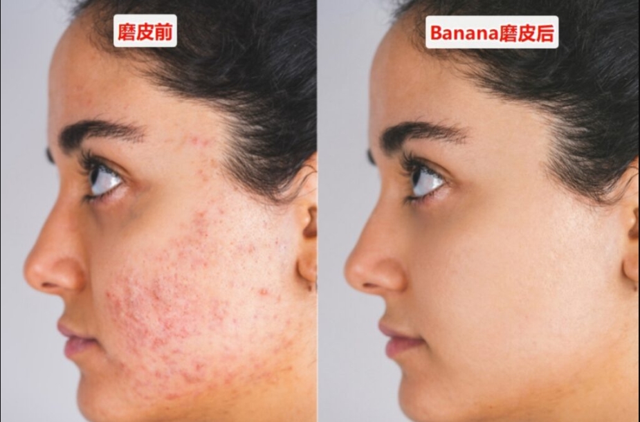 PS插件StartAI磨皮效果