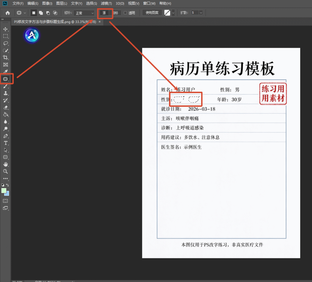 PS 软件界面截图,展示使用修补工具修改病历单练习模板图片,左侧工具栏选中修补工具,顶部选项栏设置源,画面里病历单上 “男” 字被框选,用于演示 PS 去除原有文字的操作步骤。