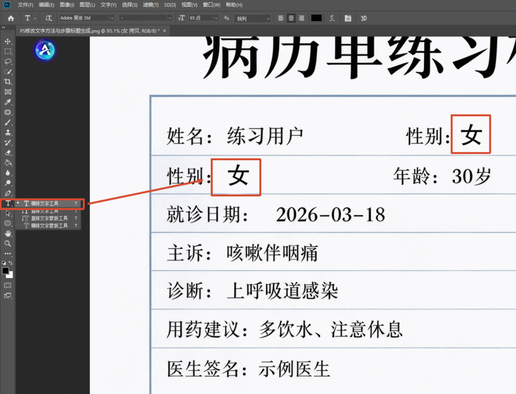 PS 软件界面截图,选中横排文字工具,在病历模板性别栏位置输入文字 “女”,字体选用 Adobe 黑体 Std,调整字号,匹配文档原有文字样式。