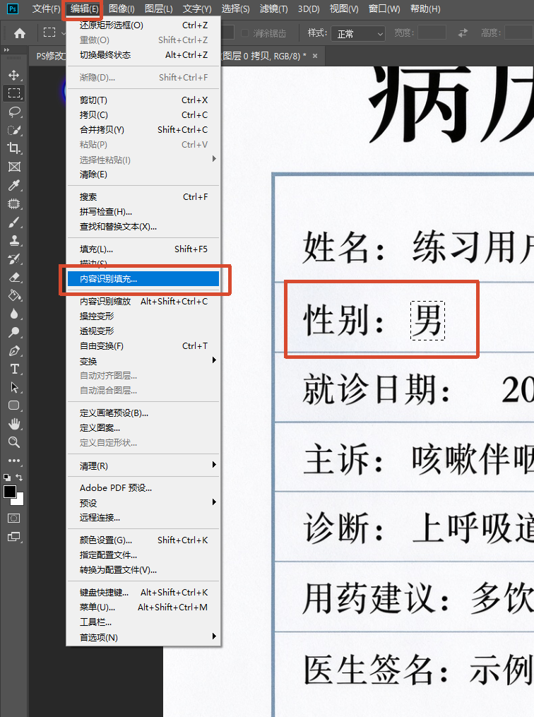 PS 软件界面截图,使用矩形选框工具框选病历模板中的 “男” 文字,点击顶部编辑菜单,选择内容识别填充功能,用来清除选中的旧文字。