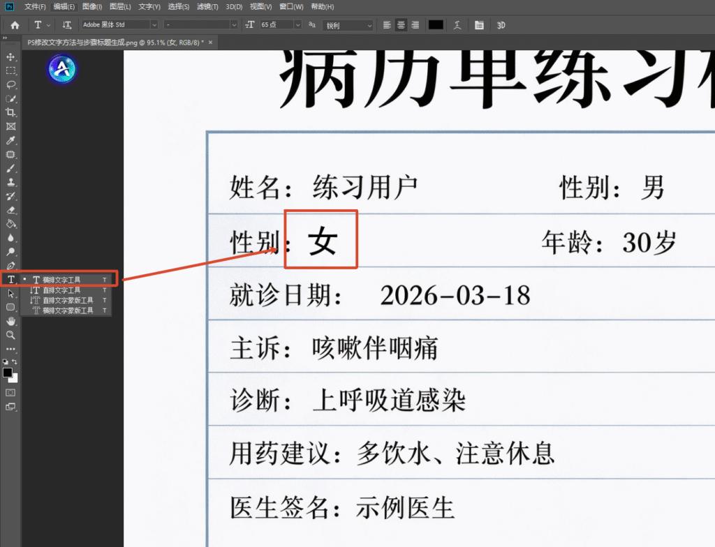 PS 软件界面截图,横排文字工具在病历模板性别栏输入文字 “女”,调整字体、字号,让新增文字和病历原有字体风格保持一致。
