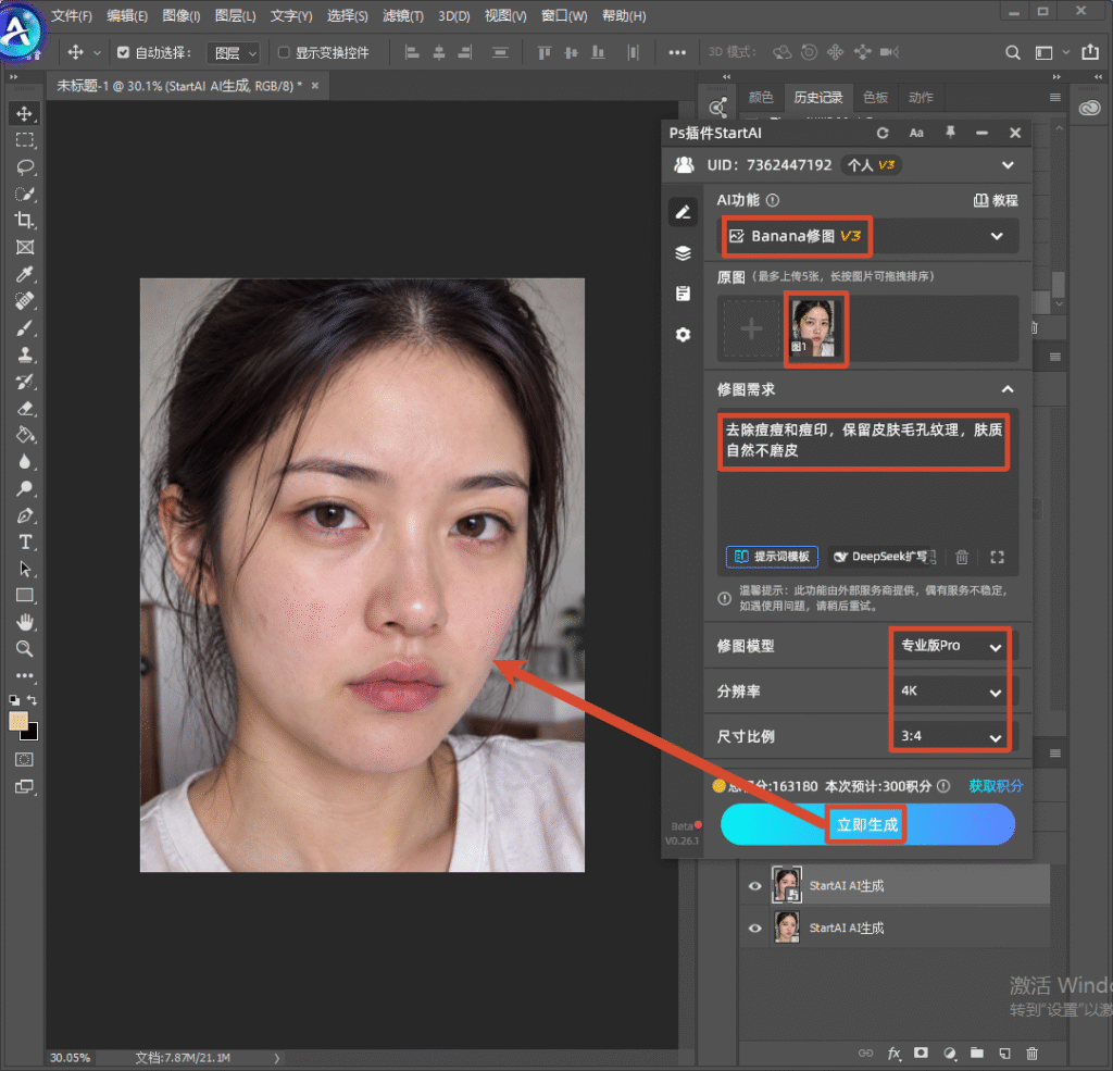 Photoshop 软件界面，右侧 StartAI 插件面板，选用 Banana 修图 V3 模型，上传人像照片，红框标注提示词：去除痘痘和痘印，保留皮肤毛孔纹理，肤质自然不磨皮；参数设置专业版 Pro、4K 分辨率、3:4 比例，箭头指向立即生成按钮，演示 AI 一键人像祛痘修图。